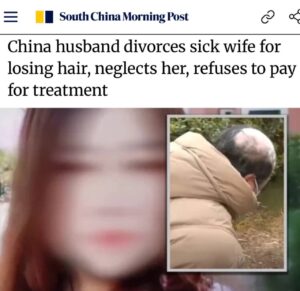 Китаец потребовал развод после того, как его жена начала лысеть из-за болезни.