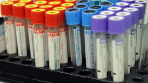 Газета.Ru: в РФ выявили повышающий риск развития осложнений при лечении рака ген